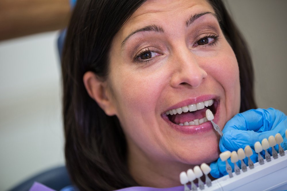 Zirconia Crowns